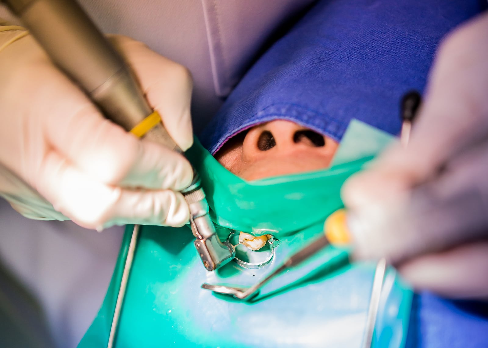 Dentist for Endosurgeries